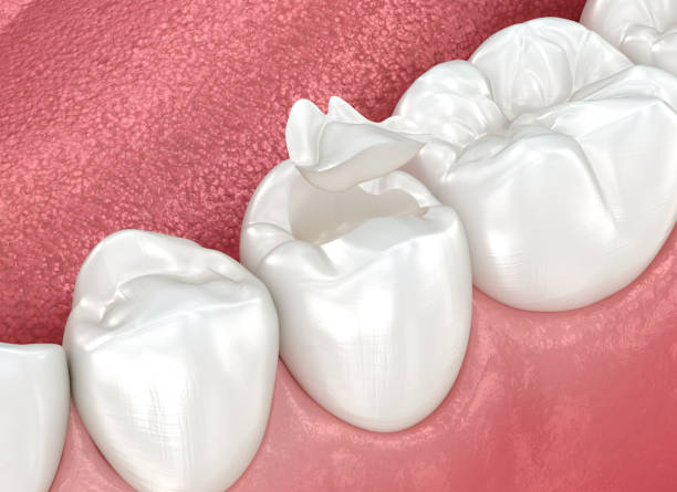 Oral Surgery in Jacksonville, AR